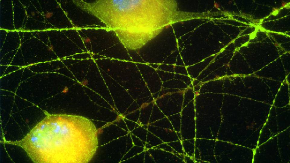 Virus being introduced into nerves