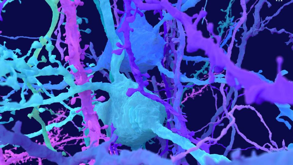 Twisting and branching neurons look like a cross between a complex highway interchange and a bowl of spaghetti.