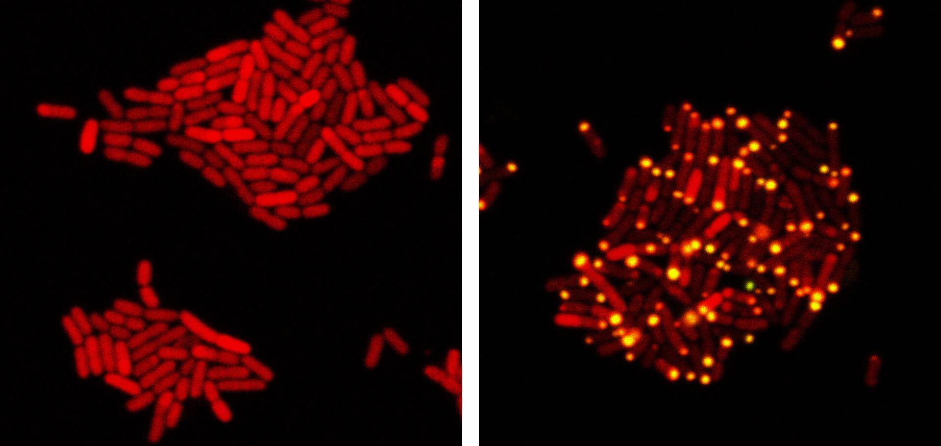 E. coli bacteria infected with eavesdropping virus